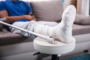 A man with a broken leg needs a Naples catastrophic injury lawyer.